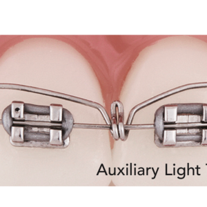 Alternative view of Lò xo Auxilary Light Torquing Arch