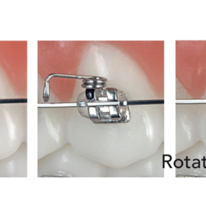Alternative view of Lò xo xoay Rotation Spring Right/Left