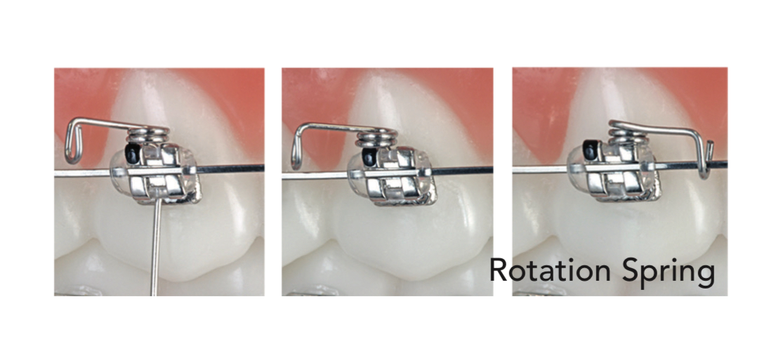 Lò xo xoay Rotation Spring Right/Left - Ảnh 2