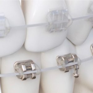 Alternative view of Dây cung ICONIX NiTi SuperElastic Cosmetic Form III Tròn/Vuông/Chữ nhật (Hộp 10 sợi)
