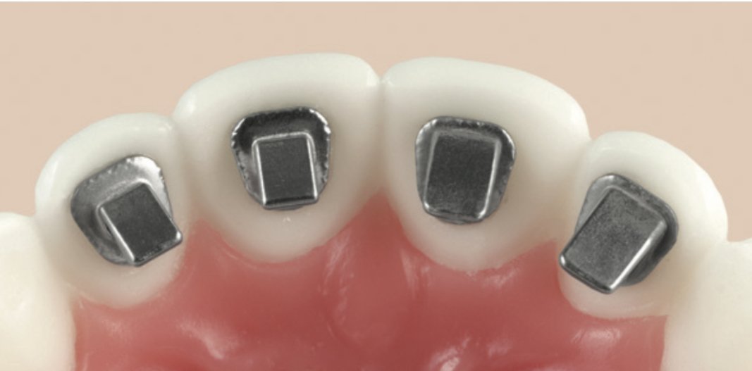 Nút chặn mặt lưỡi Bite Block (Hộp 10 chiếc) - Ảnh 2